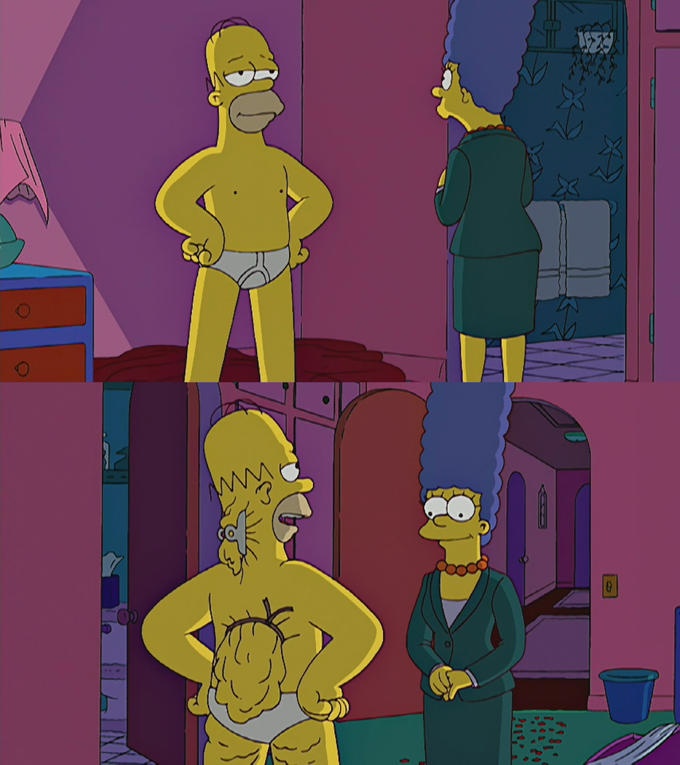 Homer Simpson'S Back Fat